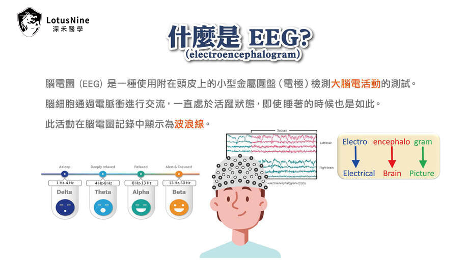 EEG 腦電圖原理說明圖
